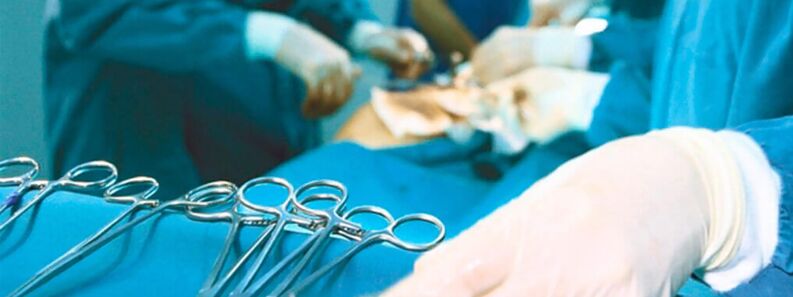 Cirurxía para agrandar o pene por un cirurxián