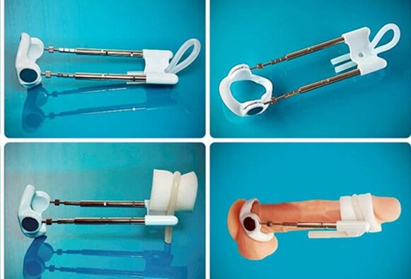 Extensor para o engrosamento do pene