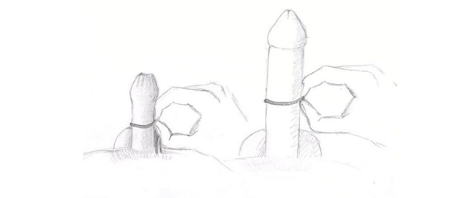 Medición do grosor do pene